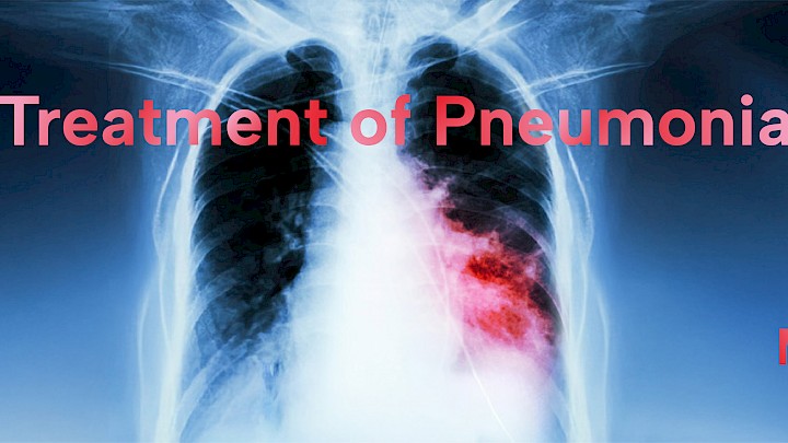 X-ray image of a lung. Above it, the terms: Treatment of Pneumonia, Guidelines, Repertory, Case Reports, Materia Medica.